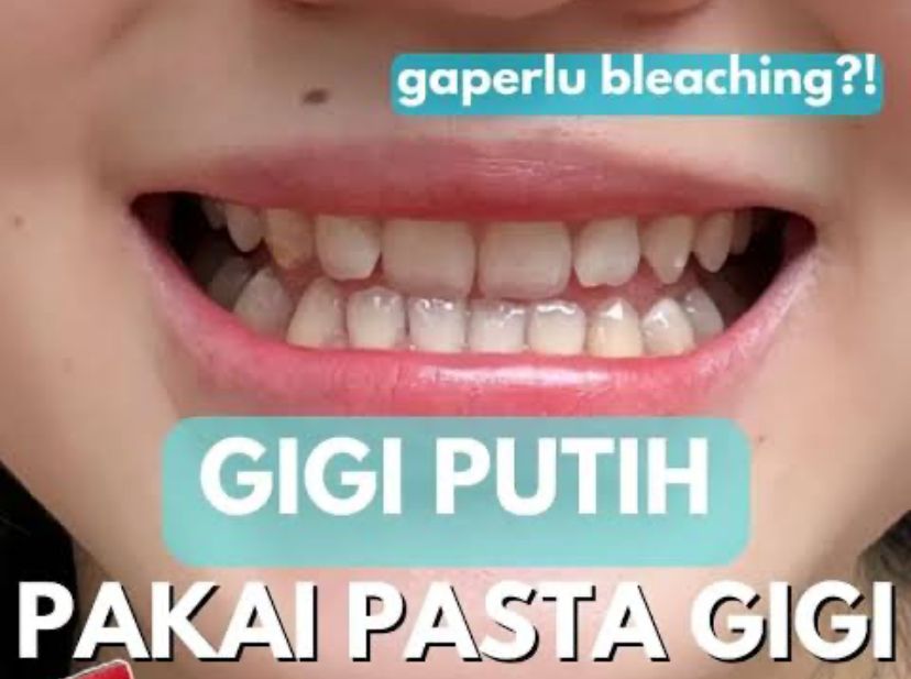 Pasta Gigi yang Diklaim Dapat Memutihkan Gigi, Yuk Simak Apa Saja!