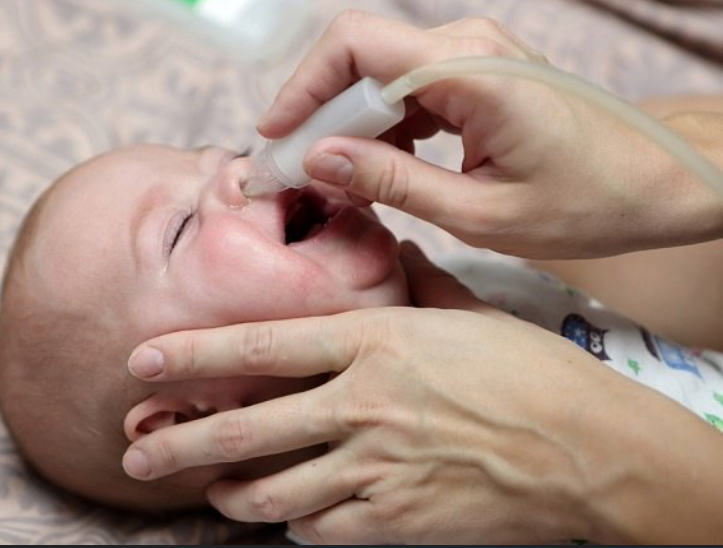 Atasi Hidung Tersumbat Bayi Pakai Bawang Merah, Benarkah Ampuh?