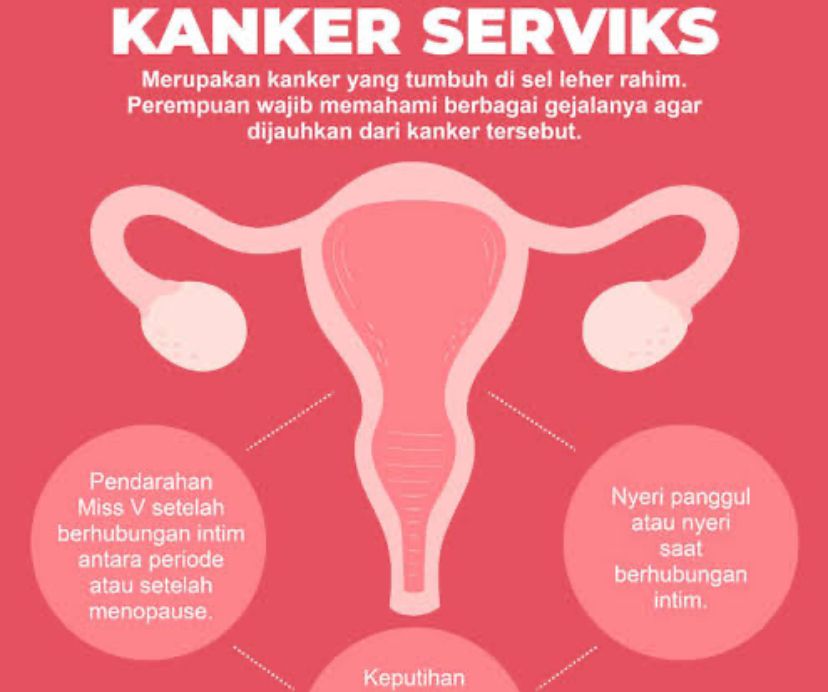 Waspadai Penyakit Kanker Serviks, Ini Informasi Pengobatannya