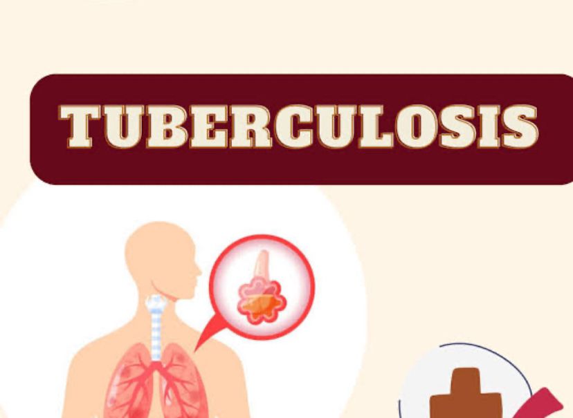 Mengenal Penyakit Turbekulosis dan Cara Pengobatannya