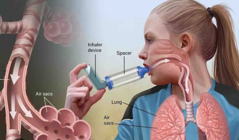 Alasan Penderita Diabetes Lebih Tinggi Risiko Terserang Asma