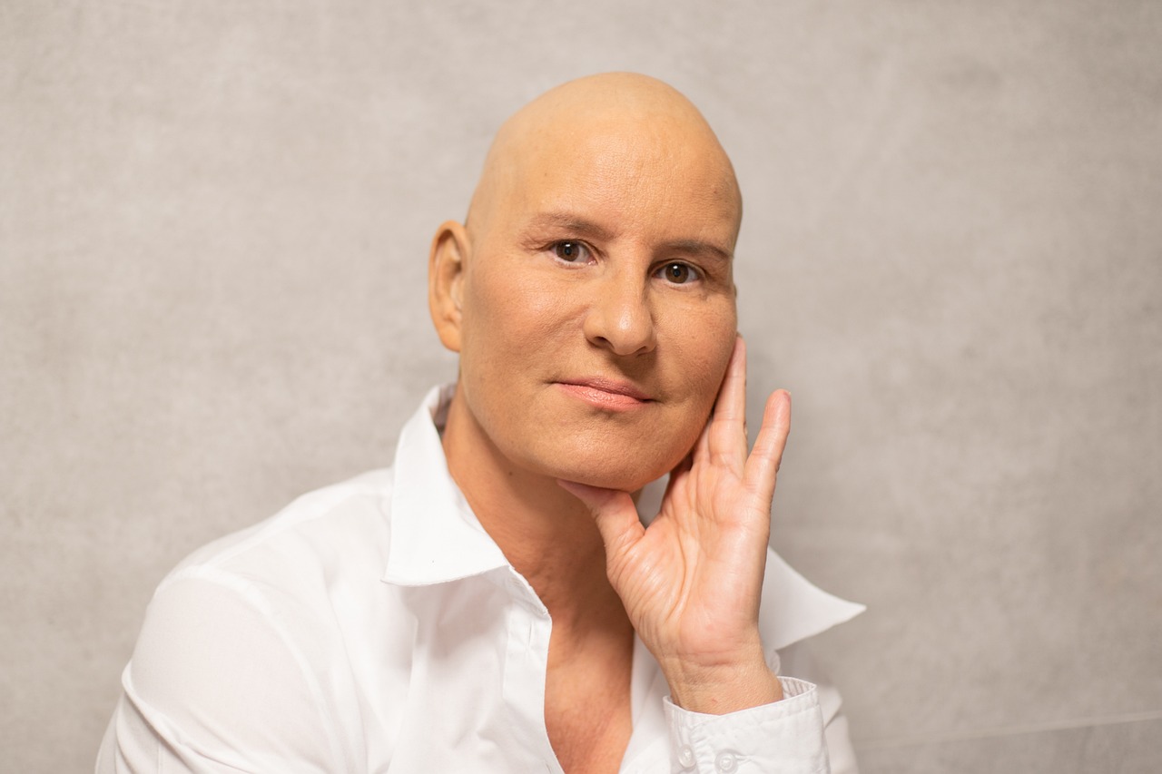 Mata dan Kulit Menguning, Waspada Kanker Pankreas! 5 Gejala Lain yang Tak Boleh Diabaikan