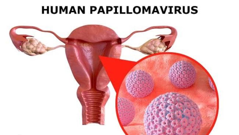 Gaya Hidup Sehat Bisa Hindari Wanita Dari Paparan Virus HPV