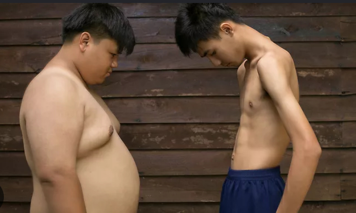 3 Penyebab Orang Bertubuh Kurus Mengalami Kolesterol Tinggi