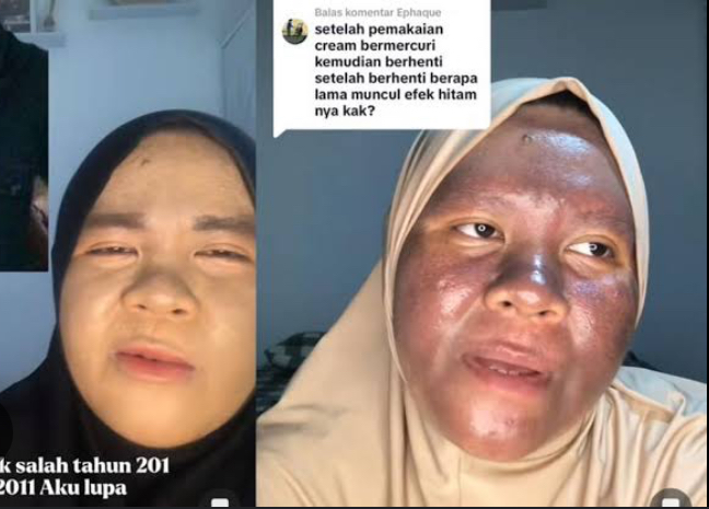 Ketahui 4 Kandungan Kosmetik Berbahaya untuk Ibu Hamil