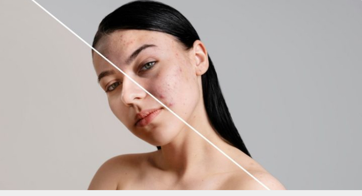 Tips Jitu Memilih Pelembap Wajah yang Pas untuk Hasil Lembap Optimal