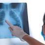 Pneumonia Misterius di China, WHO Minta Data Lengkap untuk Deteksi Penyebab
