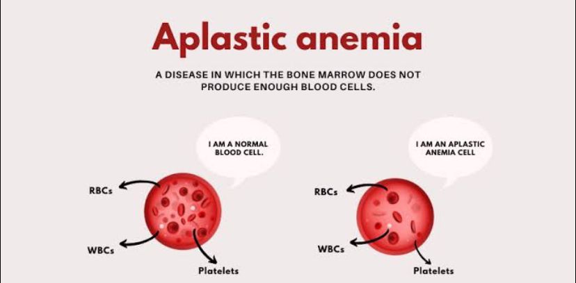 Viral di Sosial Media, Benarkah Obat Sakit Kepala Picu Anemia Aplastik?