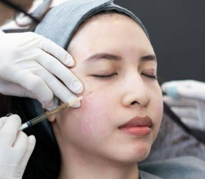 Viral Kulit Pisang Bikin Wajah Awet Muda Bak Suntik Botox, Ini Dampaknya