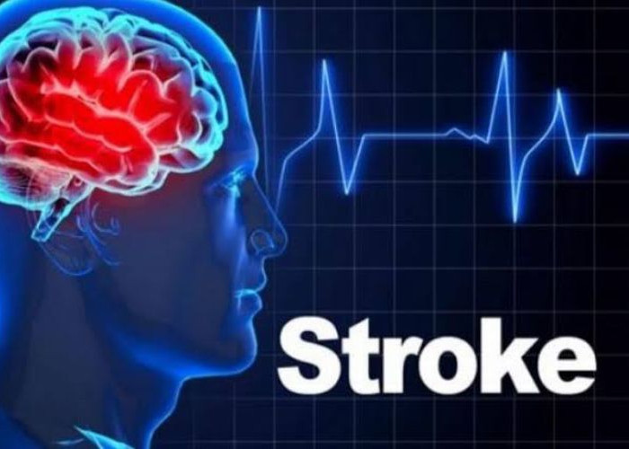 Atasi Stroke Ringan dengan Menggunakan 5 Pengobatan Alami Ini