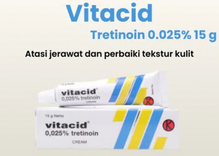 3 Salep untuk Obati Jerawat yang Membandel