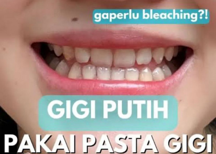 Pasta Gigi yang Diklaim Dapat Memutihkan Gigi, Yuk Simak Apa Saja!