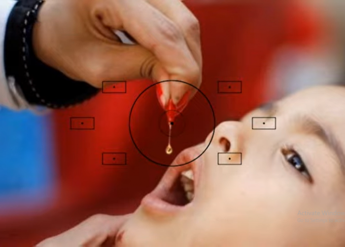 Mengatasi KLB Polio 2024: Rekomendasi Imunisasi Fio untuk Anak Usia 0-7 Tahun