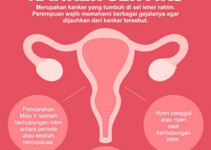 Waspadai Penyakit Kanker Serviks, Ini Informasi Pengobatannya