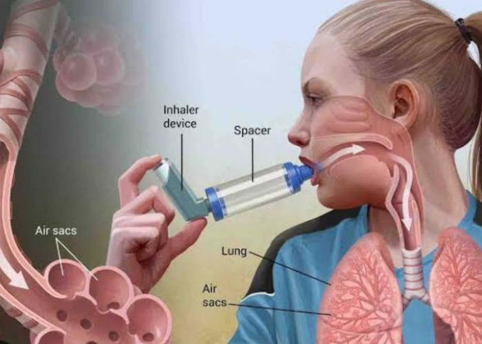 Alasan Penderita Diabetes Lebih Tinggi Risiko Terserang Asma