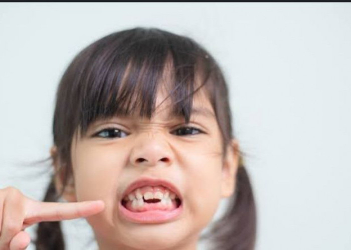 Gigi Anak Anda Cepat Berlobang? Lakukan Cara Ini Untuk Mencegahnya