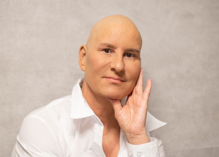 Mata dan Kulit Menguning, Waspada Kanker Pankreas! 5 Gejala Lain yang Tak Boleh Diabaikan