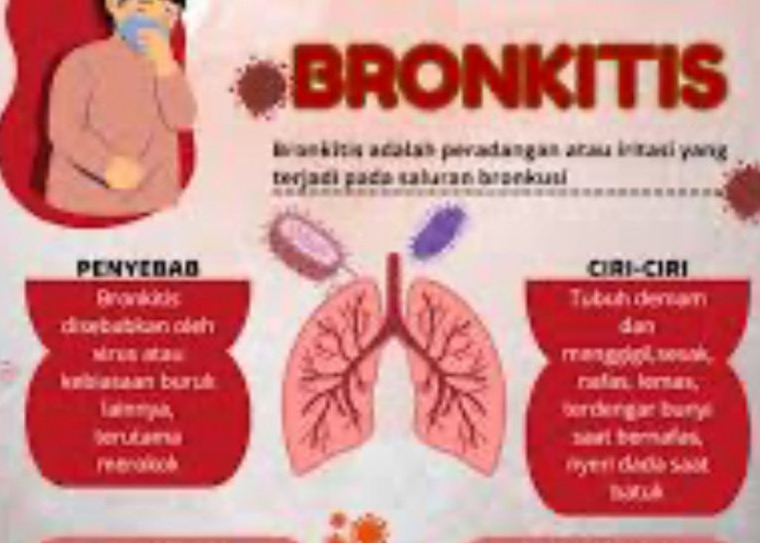 Redakan Bronkitis dengan 3 Pengobatan Alami Ini