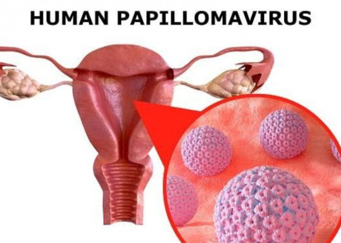 Gaya Hidup Sehat Bisa Hindari Wanita Dari Paparan Virus HPV