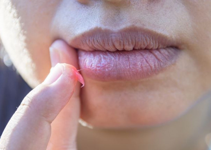 Kenapa Bibir Sering Kering? Kenali 4 Penyebab Utamanya!