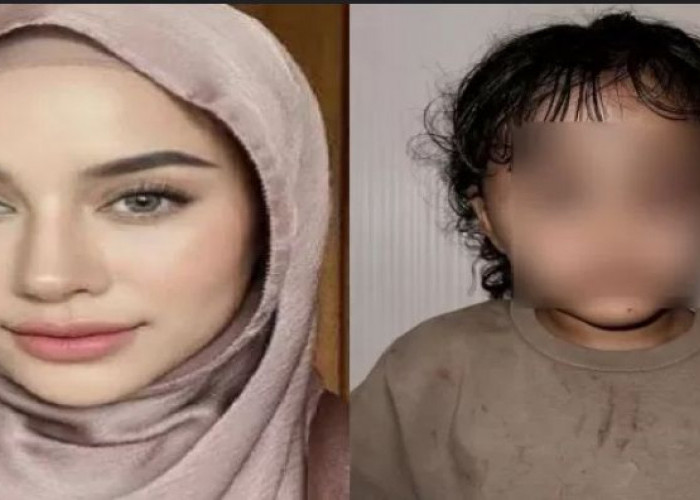 Terungkap Fakta Penganiayaan Cana Anak Dari Selebgram Emyaghnia