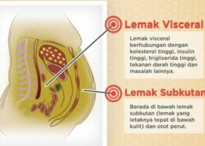 Bahaya Lemak Visceral Picu Penyakit Kronis, Berikut Cara Mencegahnya