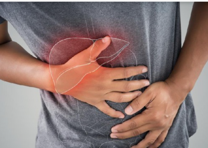 Kenali Gejala Awal Penyakit Liver, Jangan Abaikan Tanda-Tanda yang Muncul