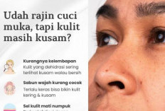 5 Kebiasaan Sepele yang Membuat Wajah Cepat Kusam Walaupun Pakai Skincare 