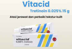 3 Salep untuk Obati Jerawat yang Membandel