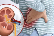 3 Pola Makan yang Cepat Meningkatkan Risiko Batu Ginjal